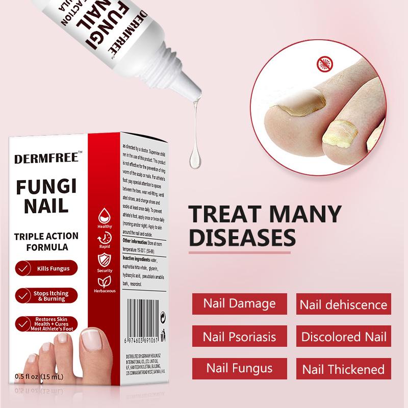 Toenail Fungus Treatment Extra Strength, Antifungal Solution for Toenail or Fingernail, Triple Action Formula for Remove Fungal, Repair and Renewal Damaged Nails, 0.5 Fl Oz