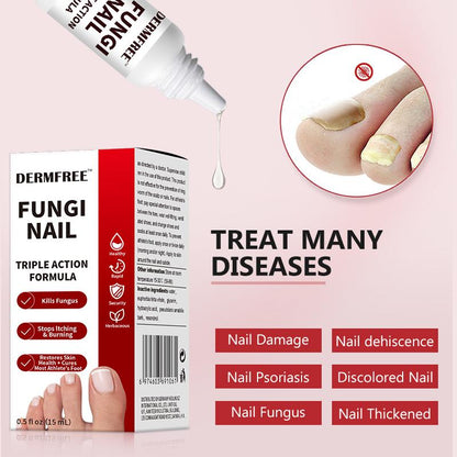 Toenail Fungus Treatment Extra Strength, Antifungal Solution for Toenail or Fingernail, Triple Action Formula for Remove Fungal, Repair and Renewal Damaged Nails, 0.5 Fl Oz